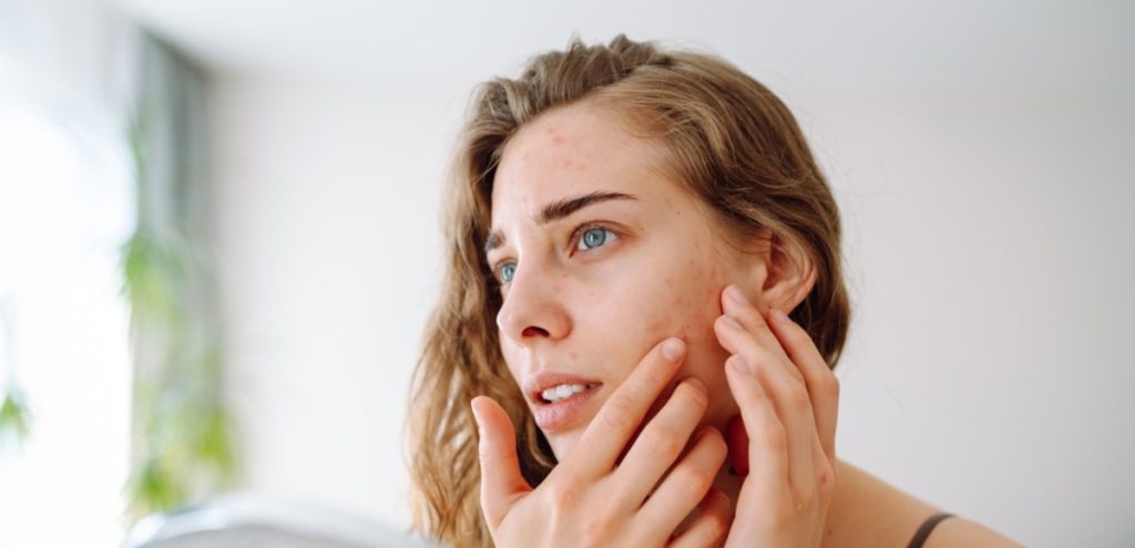 Rosacea santagostino monza