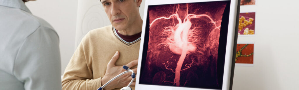 angiologia