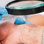 dermatologia santagostino monza