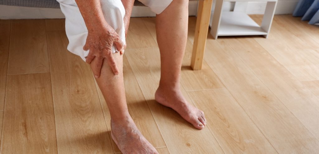 edema
