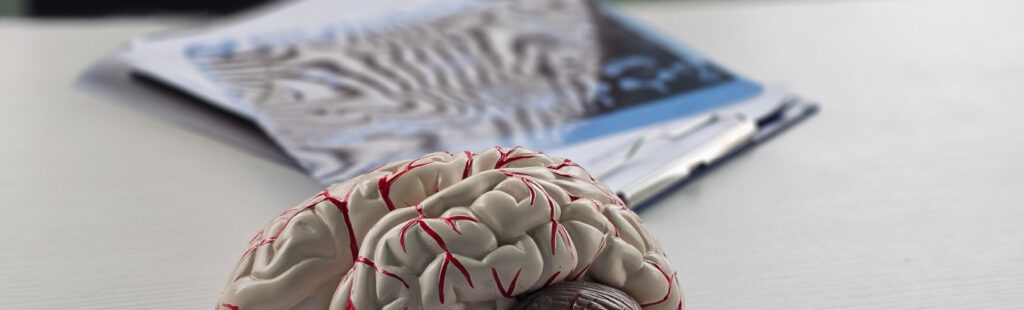 neurologia