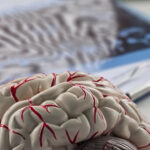 neurologia