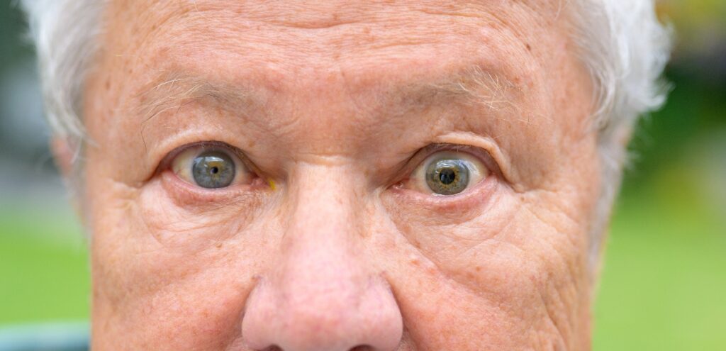 retinopatia diabetica