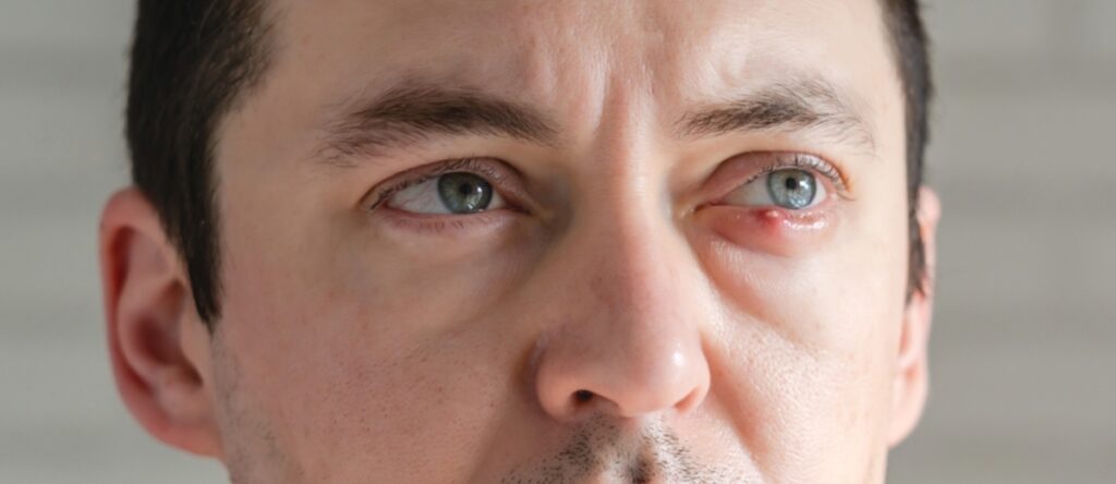 calazio santagostino monza