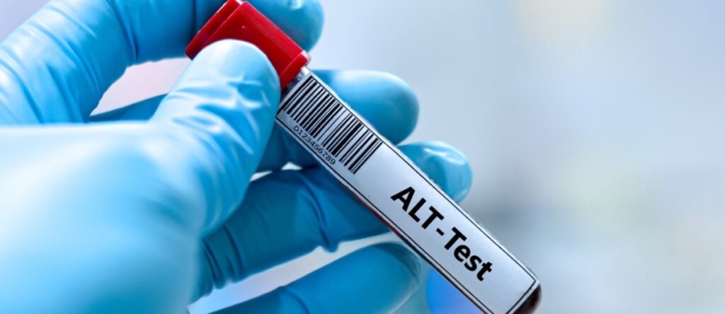 alt santagostino monza