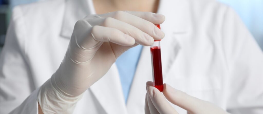 ast esami sangue santagostino monza