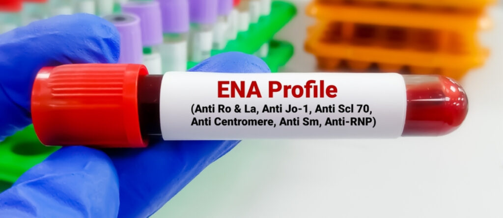 antigeni nucleari estraibili santagostino monza