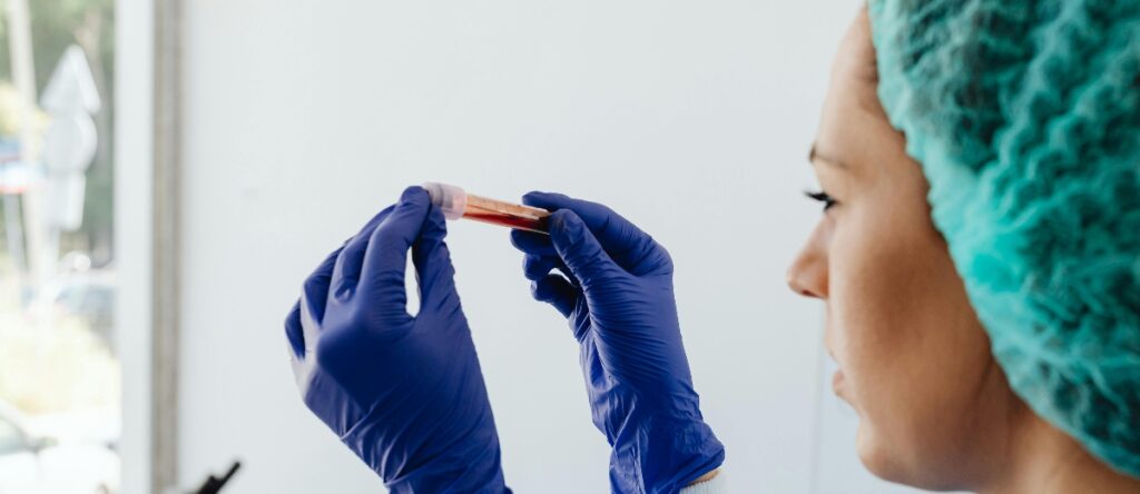 colesterolo santagostino monza