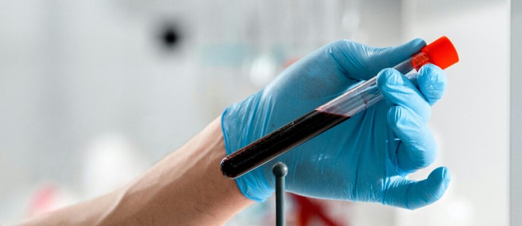 d-dimero santagostino monza