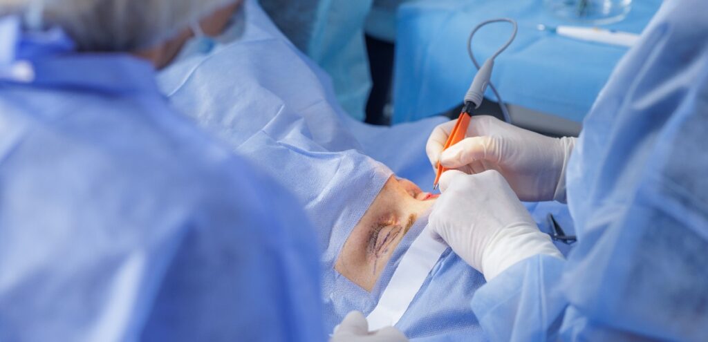 diatermocoagulazione