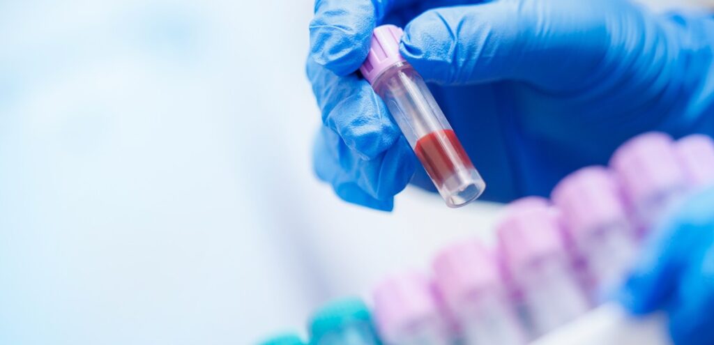 esami funzionalità epatica