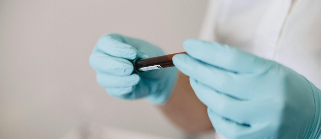 prolattina santagostino monza