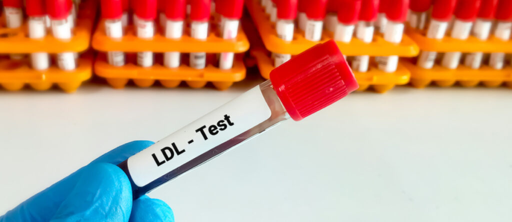 colesterolo ldl santagostino monza