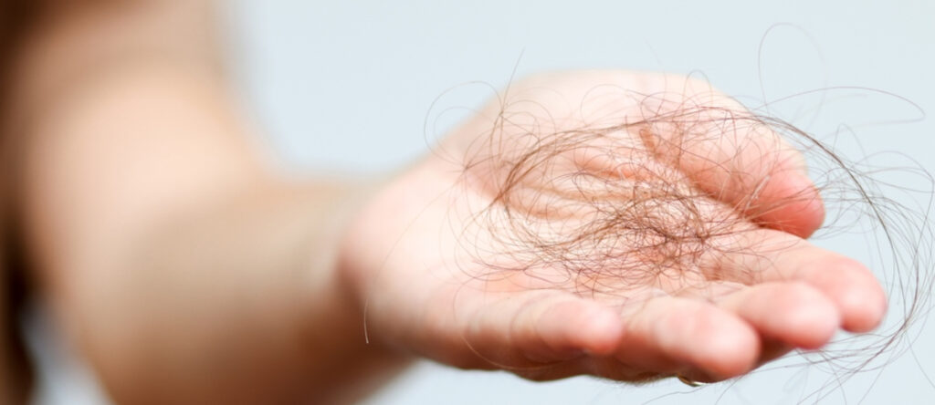 perdita dei capelli santagostino monza