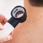 visita dermatologica monza